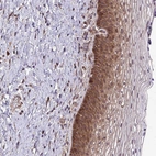 Immunohistochemical staining of human cervix, uterine shows strong cytoplasmic positivity in squamous epithelial cells.