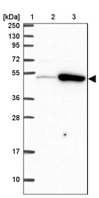 Lane 1: Marker [kDa] 250, 130, 95, 72, 55, 36, 28, 17, 10_br/_Lane 2: Human cell line RT-4_br/_Lane 3: Human cell line U-251MG sp