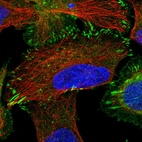 Immunofluorescent staining of human cell line U-2 OS shows localization to plasma membrane, cytosol & focal adhesion sites.