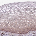 Immunohistochemical staining of human cervix, uterine shows weak to moderate cytoplasmic positivity in squamous epithelial cells.