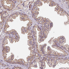 Immunohistochemical staining of human prostate shows weak to moderate membranous positivity in glandular cells.