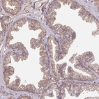 Immunohistochemical staining of human prostate shows weak to moderate membranous positivity in glandular cells.