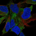 Immunofluorescent staining of human cell line AF22 shows localization to cytosol.