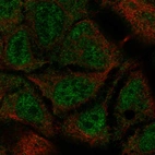 Anti-TEX40 Antibody