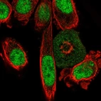 Immunofluorescent staining of human cell line PC-3 shows localization to nucleus & nucleoli.