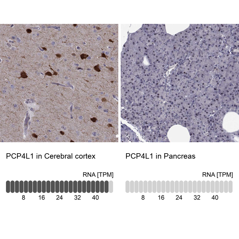 Anti-PCP4L1 Antibody