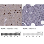 Anti-PCP4L1 Antibody