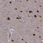 Immunohistochemical staining of human cerebral cortex shows high expression.