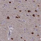 Immunohistochemical staining of human cerebral cortex shows high expression.