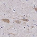 Immunohistochemical staining of human cerebral cortex shows moderate cytoplasmic positivity in neuronal cells.