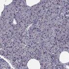 Immunohistochemical staining of human pancreas shows low expression as expected.