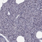 Anti-PCP4L1 Antibody