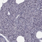 Immunohistochemical staining of human pancreas shows low expression as expected.