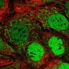 Immunofluorescent staining of human cell line CACO-2 shows localization to nucleoplasm & mitochondria.