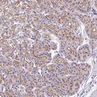 Anti-IQCJ Antibody