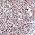Anti-IQCJ Antibody