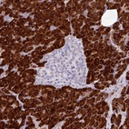 Anti-RGS21 Antibody