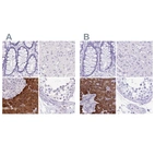 Immunohistochemical staining of human colon, liver, pancreas and testis using Anti-ERP27 antibody HPA052851 (A) shows similar protein distribution across tissues to independent antibody HPA039636 (B).