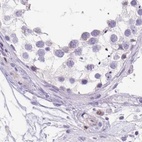 Immunohistochemical staining of human testis using Anti-ERP27 antibody HPA052851.