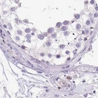 Immunohistochemical staining of human testis using Anti-ERP27 antibody HPA052851.