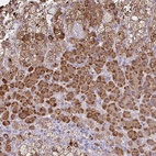 Anti-JMJD4 Antibody