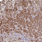 Anti-JMJD4 Antibody