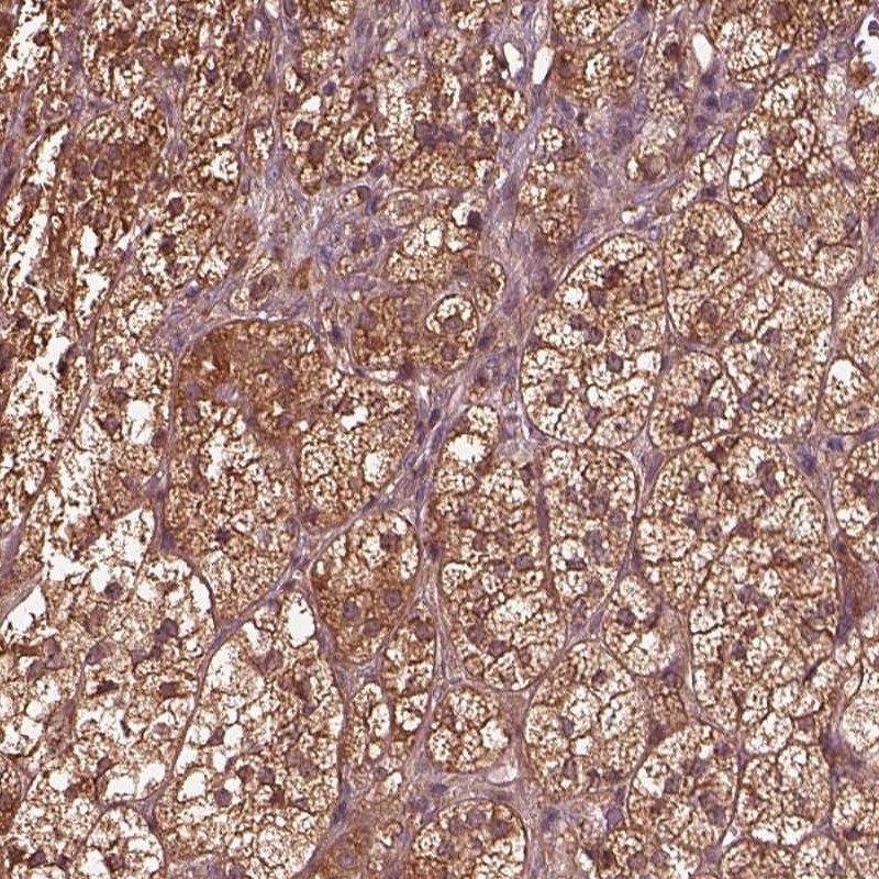 Anti-ASCC2 Antibody