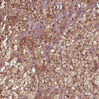 Anti-ASCC2 Antibody