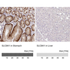 Anti-SLC9A1 Antibody