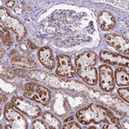 Immunohistochemical staining of human kidney shows strong granular cytoplasmic positivity in cells in tubules.