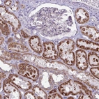 Immunohistochemical staining of human kidney shows strong granular cytoplasmic positivity in cells in tubules.