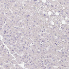 Anti-SLC9A1 Antibody