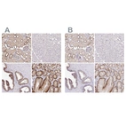 Immunohistochemical staining of human kidney, liver, prostate and stomach using Anti-SLC9A1 antibody HPA052891 (A) shows similar protein distribution across tissues to independent antibody HPA048532 (B).