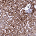 Immunohistochemical staining of human liver shows strong granular cytoplasmic positivity in hepatocytes.