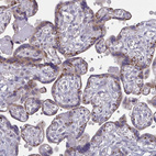 Immunohistochemical staining of human placenta shows moderate granular cytoplasmic positivity in trophoblastic cells.