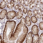 Immunohistochemical staining of human stomach shows strong membranous/cytoplasmic positivity in glandular cells.