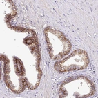 Immunohistochemical staining of human prostate shows moderate membranous/cytoplasmic positivity in glandular cells.