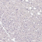 Immunohistochemical staining of human liver shows no positivity in hepatocytes as expected.