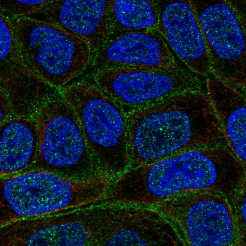 Anti-C4orf19 Antibody