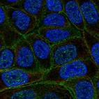 Anti-C4orf19 Antibody