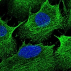 Immunofluorescent staining of human cell line U-2 OS shows localization to plasma membrane & actin filaments.