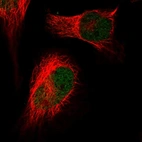 Anti-HIRA Antibody