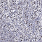 Anti-CASD1 Antibody