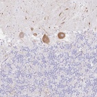 Anti-DKK4 Antibody