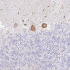 Anti-DKK4 Antibody
