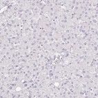 Immunohistochemical staining of human liver shows no positivity in hepatocytes as expected.
