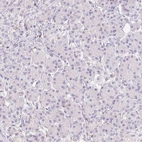 Immunohistochemical staining of human pancreas shows no positivity in exocrine glandular cells as expected.