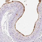 Immunohistochemical staining of human epididymis shows strong positivity in apical membranes of glandular cells.