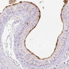 Immunohistochemical staining of human epididymis shows strong positivity in apical membranes of glandular cells.