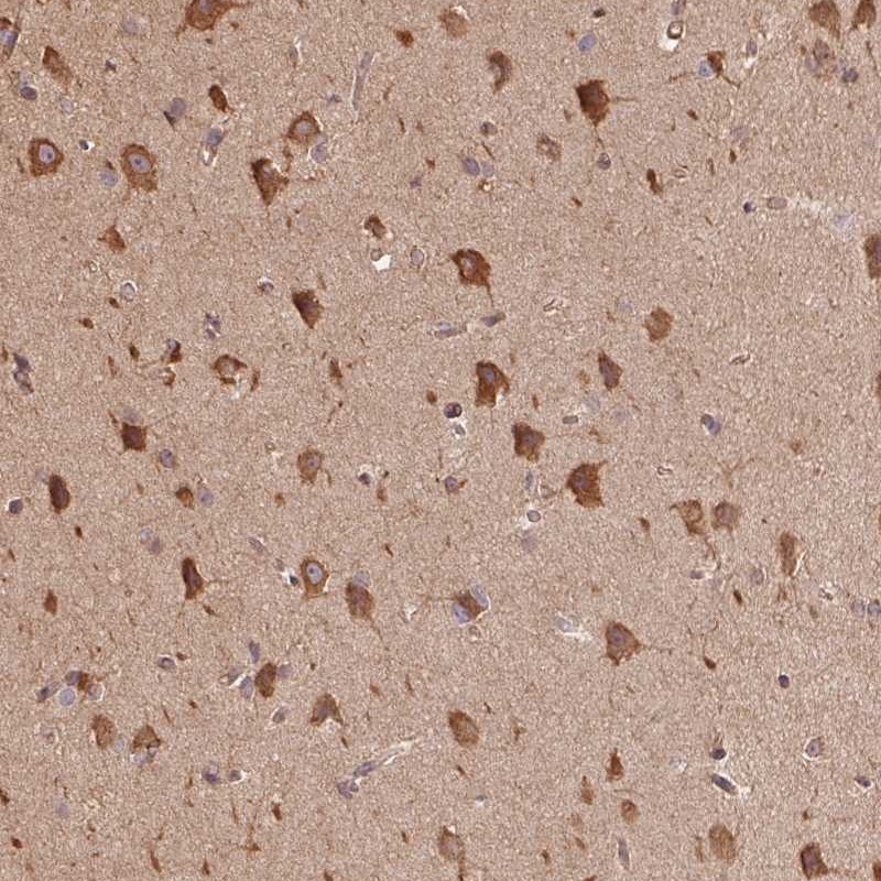 Anti-C6orf163 Antibody